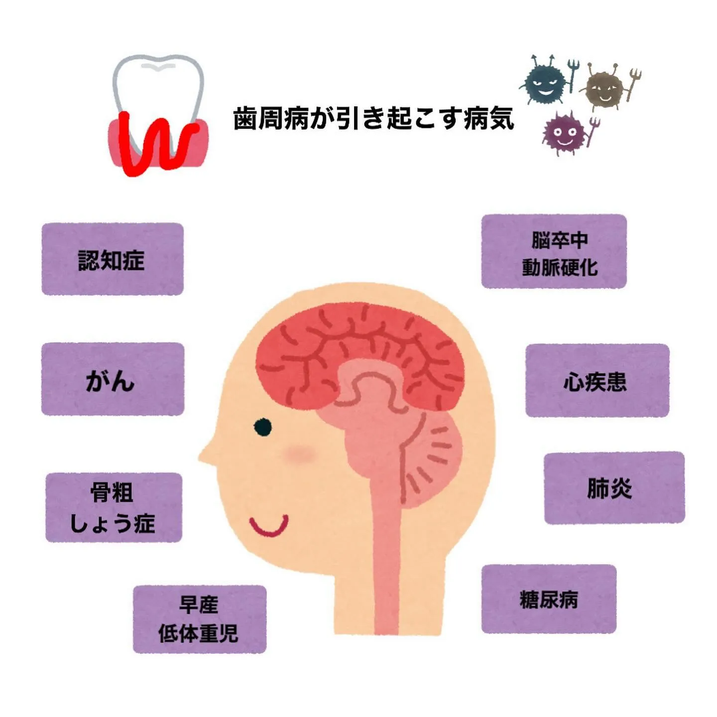 疾病リスクを引き上げる“口腔内細菌”👾